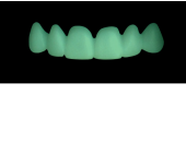 Cod.C7Facing : 10x  wax facings-bridges,  SMALL, Square ovoid, TOOTH 13-23, compatible with Cod.A7Lingual,TOOTH 13-23 for long-term provisionals preparation